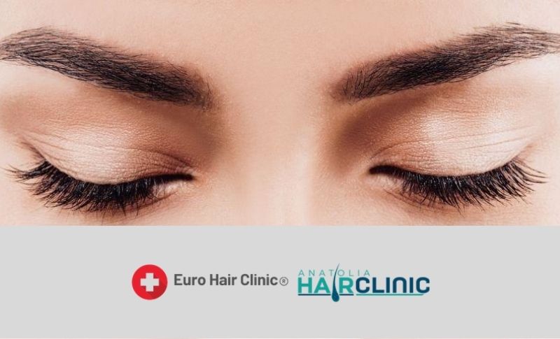 eyebrow implant